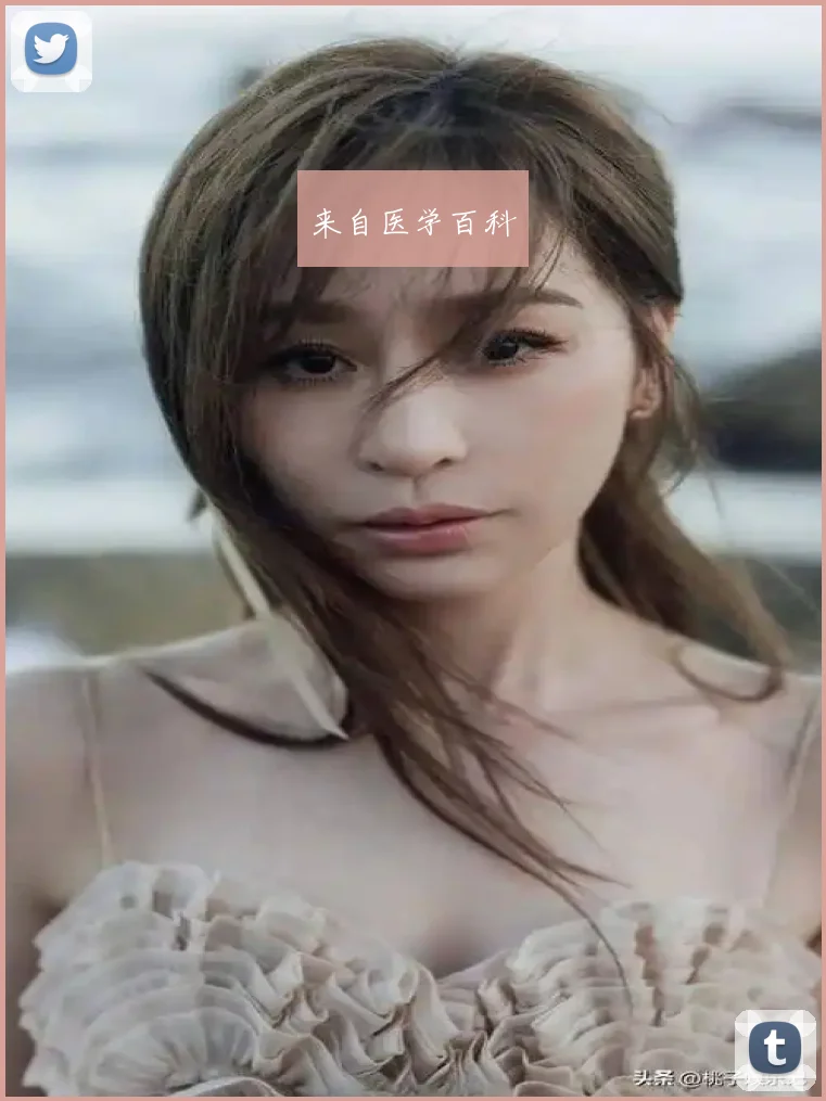 来自医学百科