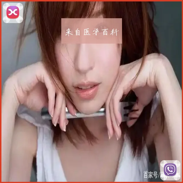 来自医学百科